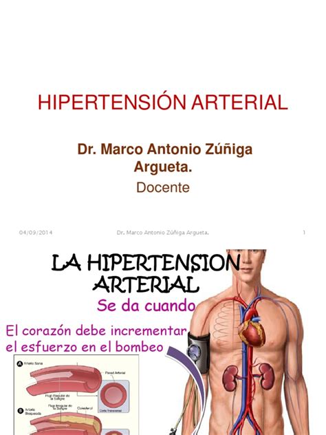 PDF Hipertension Arterial Diagnostico Manejo Y Tratamiento DOKUMEN TIPS