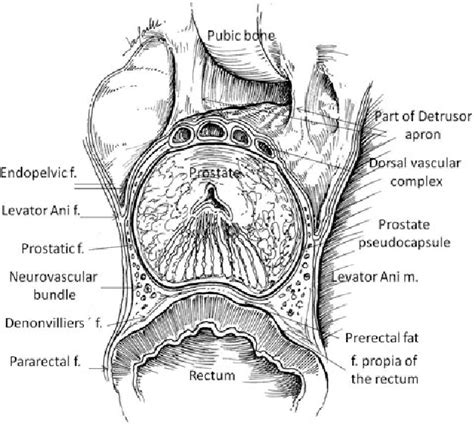 Figure From Surgical Anatomy Of Radical Prostatectomy Periprostatic