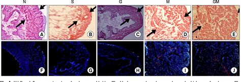 Figure From The Effect Of Human Muscle Derived Stem Cells Mdsc And