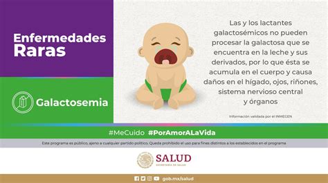 Salud M Xico On Twitter Enfermedadesraras I Galactosemia La