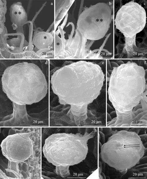 Glandular Trichomes In The Epidermis Of R Idaeus Laszka And