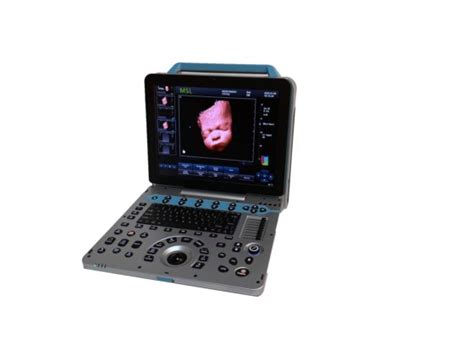 Middle End 4d Portable Color Ultrasound Machine Medical Ultrasound