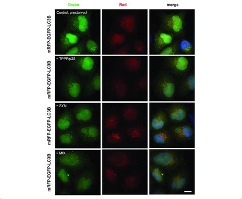 Effects Of Syn And Or Tppp P On The Autophagy Maturation In