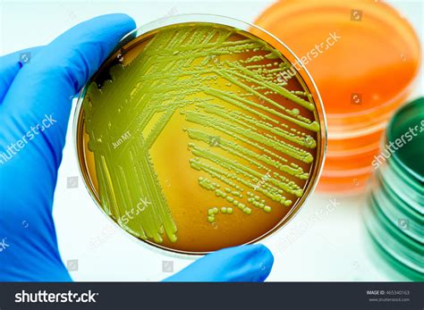 Colonies Yellow Bacteria Micrococcus Luteus Blood Stock Photo 465340163 ...