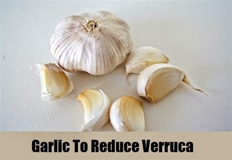 6 EFFECTIVE HERBAL REMEDIES FOR VERRUCA ~ Mzizi Mkavu