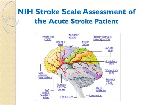 nih stroke scale assessment   acute stroke patient