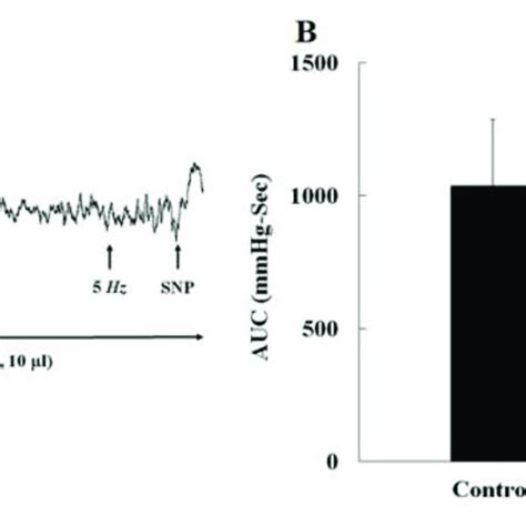 Acute Effects Of Ketamine On The Electrical Stimulation After Major