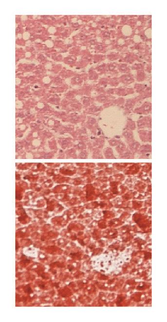 Effect Of ECD And LGZGD On Hepatic Morphology And Pathological Changes