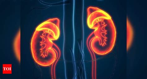 Metastatic renal cell carcinoma and its treatment - Times of India