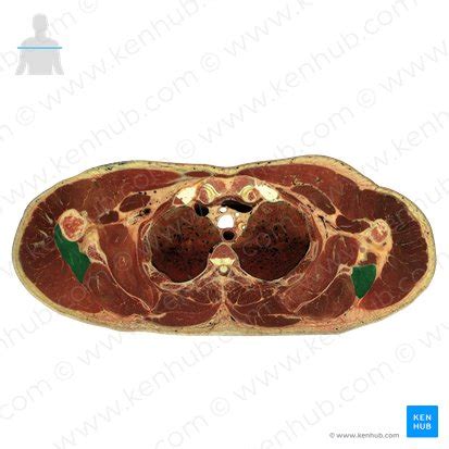 Musculus Teres Minor Anatomie Funktion Und Versorgung Kenhub