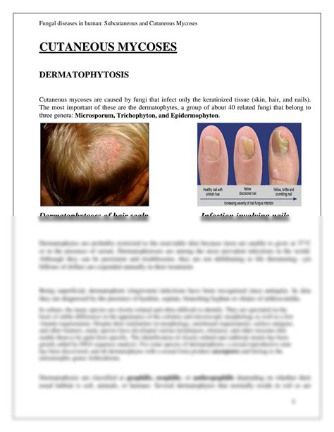 SOLUTION Mycology Fungal Diseases In Humans Cutaneous And Subcutaneous