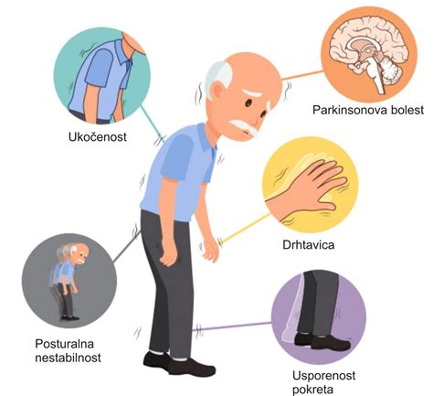 Parkinsonova Bolest Prvi Dio Natus Hr