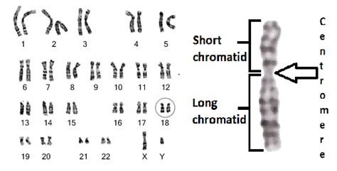 Human karyotype. Chromosome Structure | Download Scientific Diagram