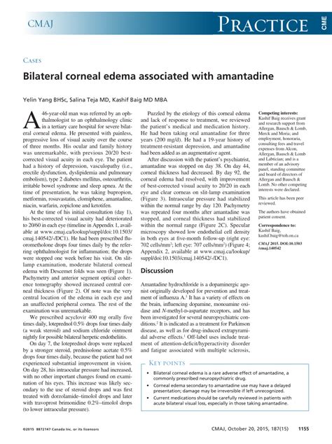 Pdf Bilateral Corneal Edema Associated With Amantadine