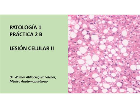 Patologia 1 Semana 2 Practica 2B PATOLOGÍA 1 PRÁCTICA 2 B LESIÓN