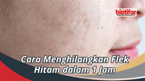 Cara Menghilangkan Flek Hitam Dalam Jam Biotifor