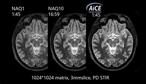 Mri Scanners Canon Global Hot Sex Picture