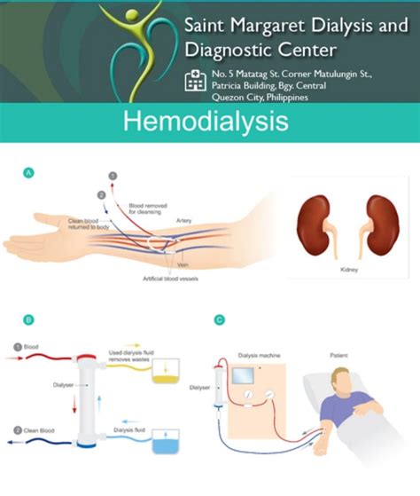 St - Want to make sure that you have quality hemodialysis treatment? We