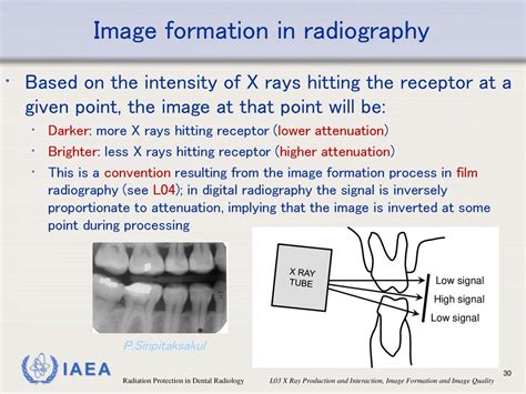 Radiation Protection In Dental Radiology Ppt Download