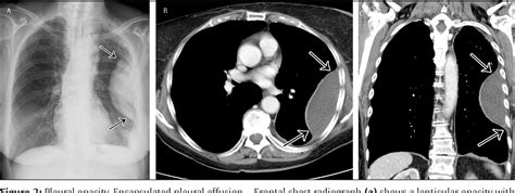 Figure 2 from Comparative Interpretation of CT and Standard Radiography ...