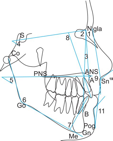 Angular Measurements 1 Sna 2 Snb 3 Anb 4 Sn Gome 5 Mm 6 Download Scientific Diagram