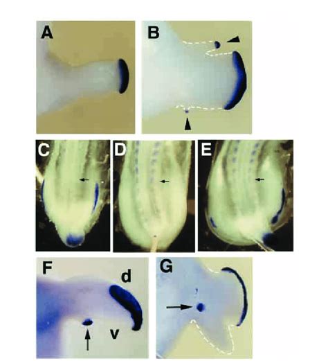 Aer Formation Is Altered By Loss Of Bmp Function Ab Noggin Infected