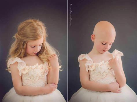 Dad Shaves His Head To Match Daughter With Alopecia After She Says I