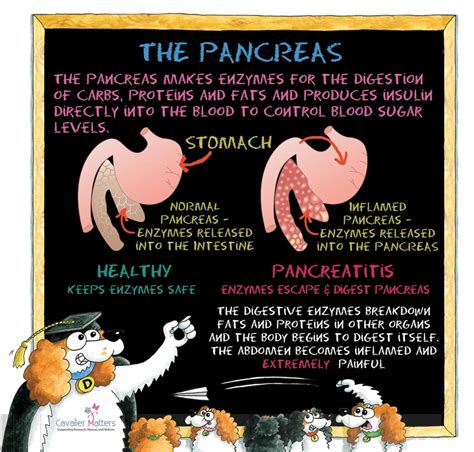 Chronic Pancreatitis (CP) – Cavalier Matters