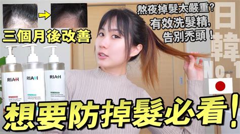 真的不禿了日本人掉髮如何自救？三個月見效公開護髮真實感受，日本網購no1韓國神仙防掉髮洗髮精！｜好物分享｜kodootv Youtube