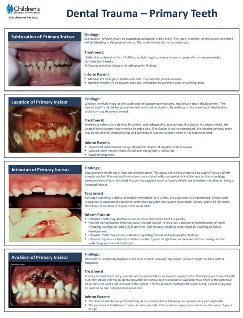 Dental Trauma Flip Chart Primary Pdf