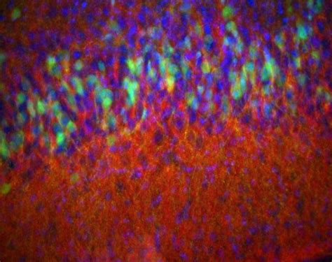 piriform cortex alchetron   social encyclopedia