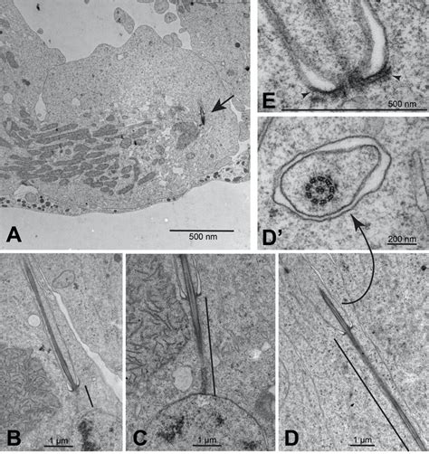 Dynamics Of Spermatocyte Cilia During Meiotic Divisions A Late Download Scientific Diagram