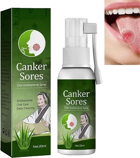 Oral Ulcer Relief Spray Protect Teeth And Gums Canker Sore Relief Spray Oral Ulcer Spray Gum