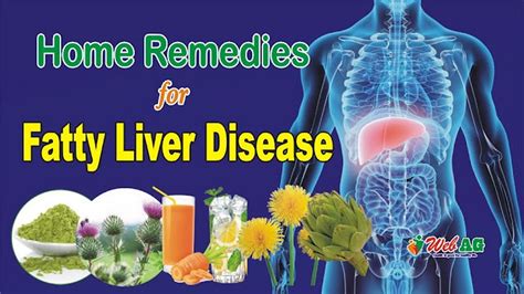 Home Remedies For Fatty Liver Treat Fatty Liver At Home