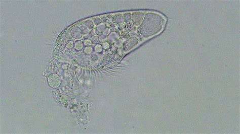 Watching This Single-Cell Organism Die is Oddly Moving