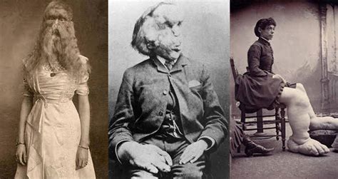 25 Tragic Photos From Freak Shows Of Decades Past