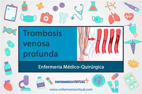 Trombosis venosa profunda Guía de Enfermería 2024