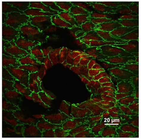 En Face Preparation of Mouse Blood Vessels (article) | JoVE