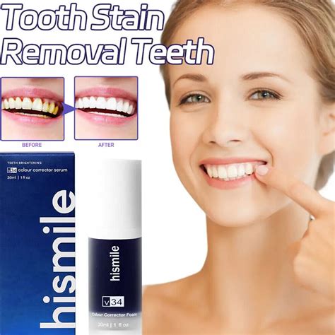 Hismile V34 Colour Corrector Purple Teeth Whitening Tooth Stain