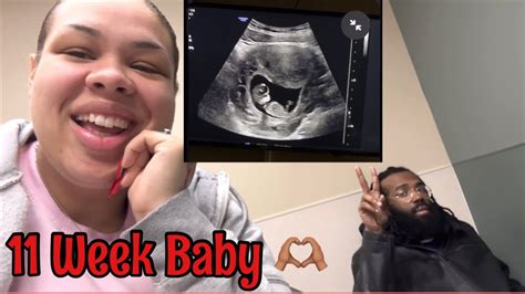 Week Baby Apt Ultrasound Video Included Gender Blood Work Youtube