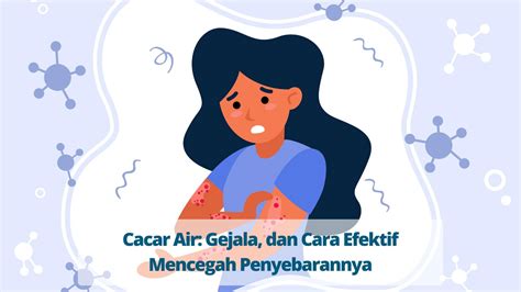 Cacar Air Gejala Dan Cara Efektif Mencegah Penyebarannya