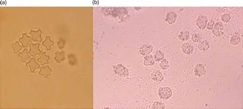 Acanthamoeba Cysts A Â100 And Trophozoites B Â100 Download Scientific Diagram