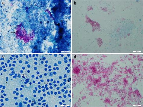 Acid Fast Stain Mycobacterium Paratuberculosis In Feces