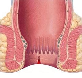 Proctologia Emorroidi Fistole Anali Ragade Anale Dott Bruno