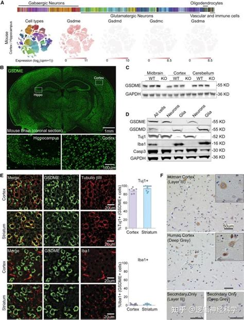 Neuron Gsdme