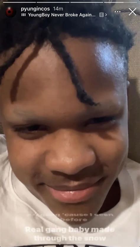 This Dumb Ass Sped Looking Nigga Has Been Making NBA Look Bad For Months With His Attention