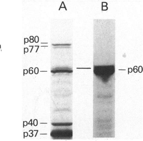 Autoradiogram Of 35s Methionine Labeled Proteins In Minicells