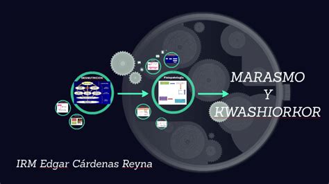 Marasmo Y Kwashiorkor By Edgar Cárdenas On Prezi