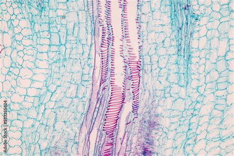 Plant tissue Structure, section (tissue) of stem plant tissue under a ...