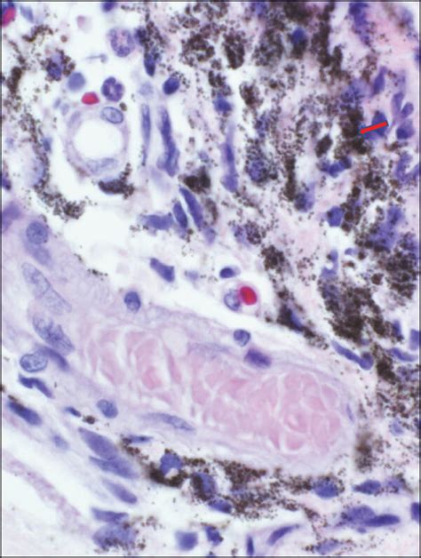 A Showing Light Microscopy And B Higher Magnification With